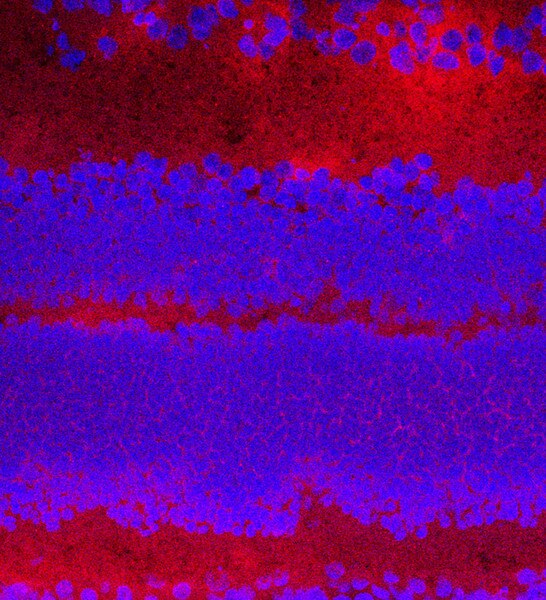 IF of P10 mouse retina labeled with DSHB antibody CPTC-EPHB4-1 aginst EPH receptor B4 (red). Image credit Lachke Laboratory, University of Delaware